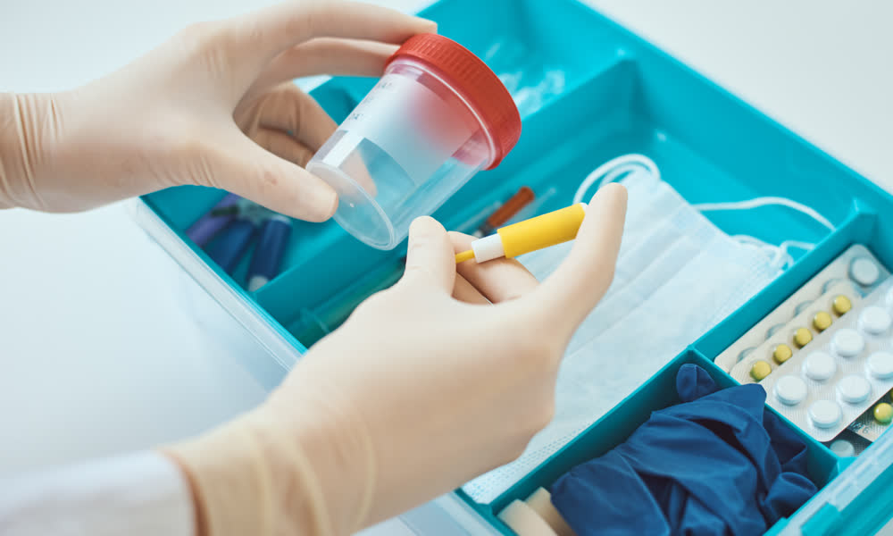 STI testing consultation